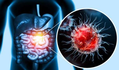 Ese hagati y'Abagore n'Abagabo ni bande bibasirwa na cancer cyane?. _ISHEJA